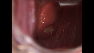 Avy Agored Pussy gyda Speculum