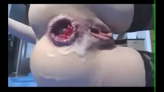 Nerdy കൗമാരം മുഷ്ടി പഞ്ച് her ass to ആകർഷണീയമായ orgasm squirting